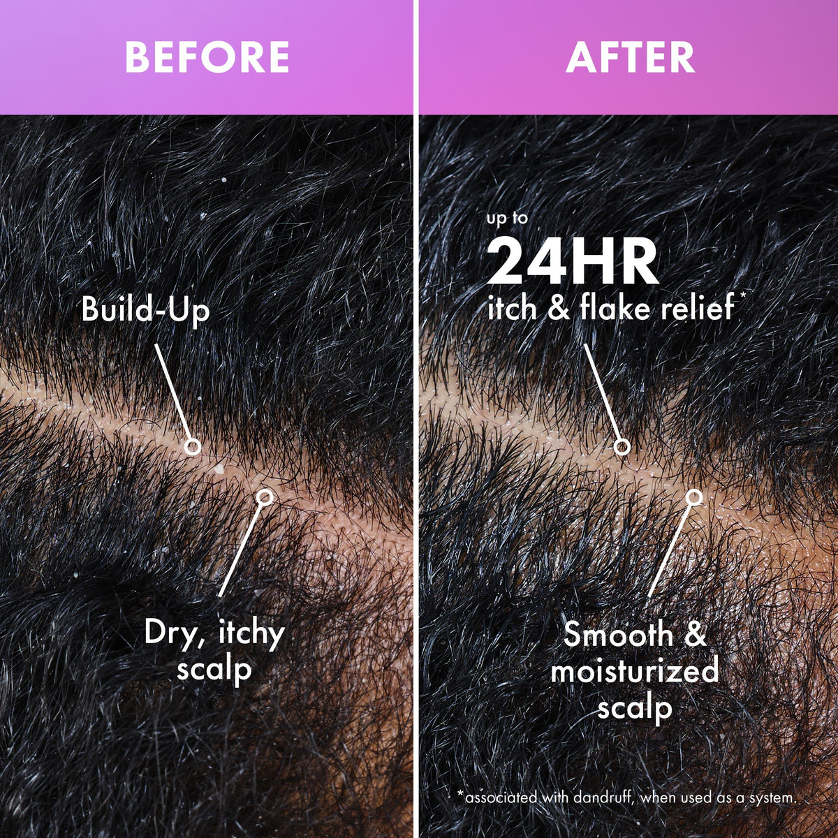 Lavender & Lychee Scalp & Hair Build Up Remover